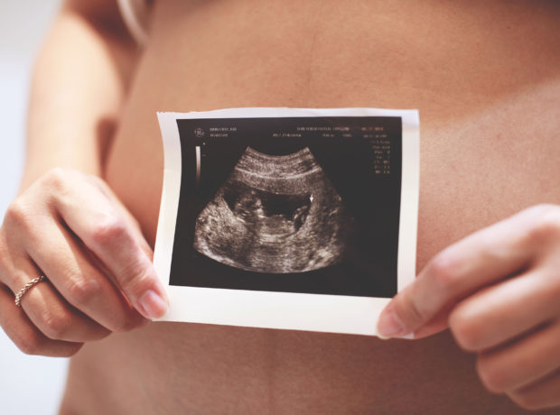 Pregnancy scan