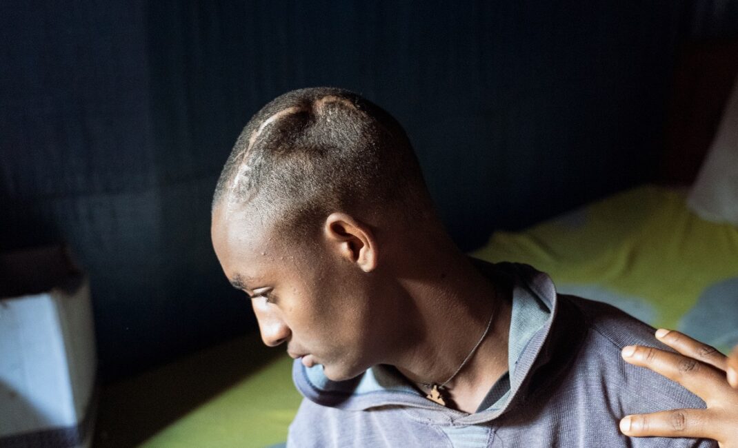  Photograph by Jaclynn Ashly showing a young Ethiopian man's head from the side; he has a severe head injury due to having been attacked